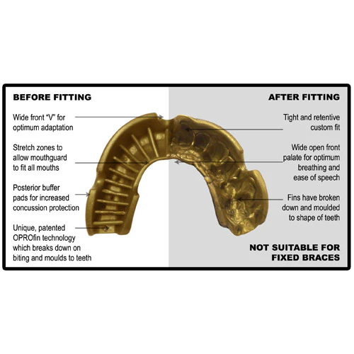 Protecteur buccal OPRO - Image 4